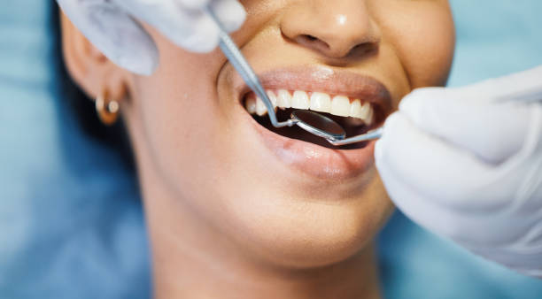 Best Emergency Dental Care for Broken or Chipped Teeth in Wilson, NC