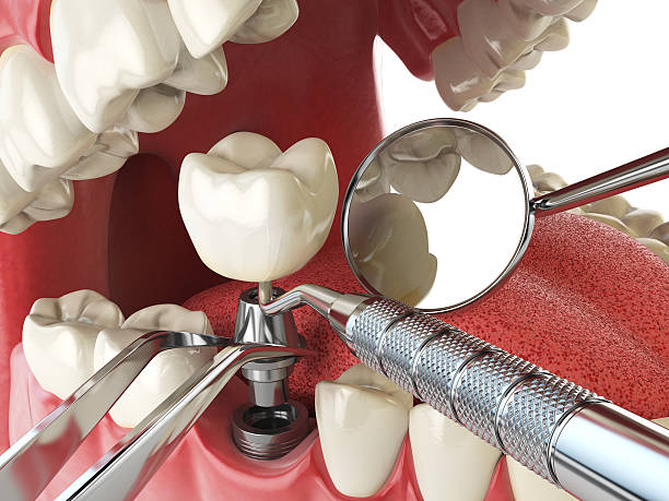 Best Weekend Emergency Dentist in Wilson, NC