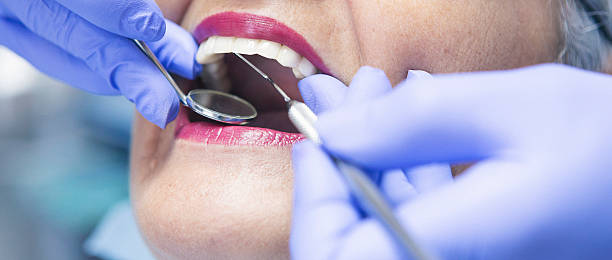 Best Emergency Root Canal Treatment in Wilson, NC