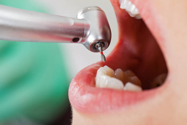 Best Emergency Gum Treatment in Wilson, NC